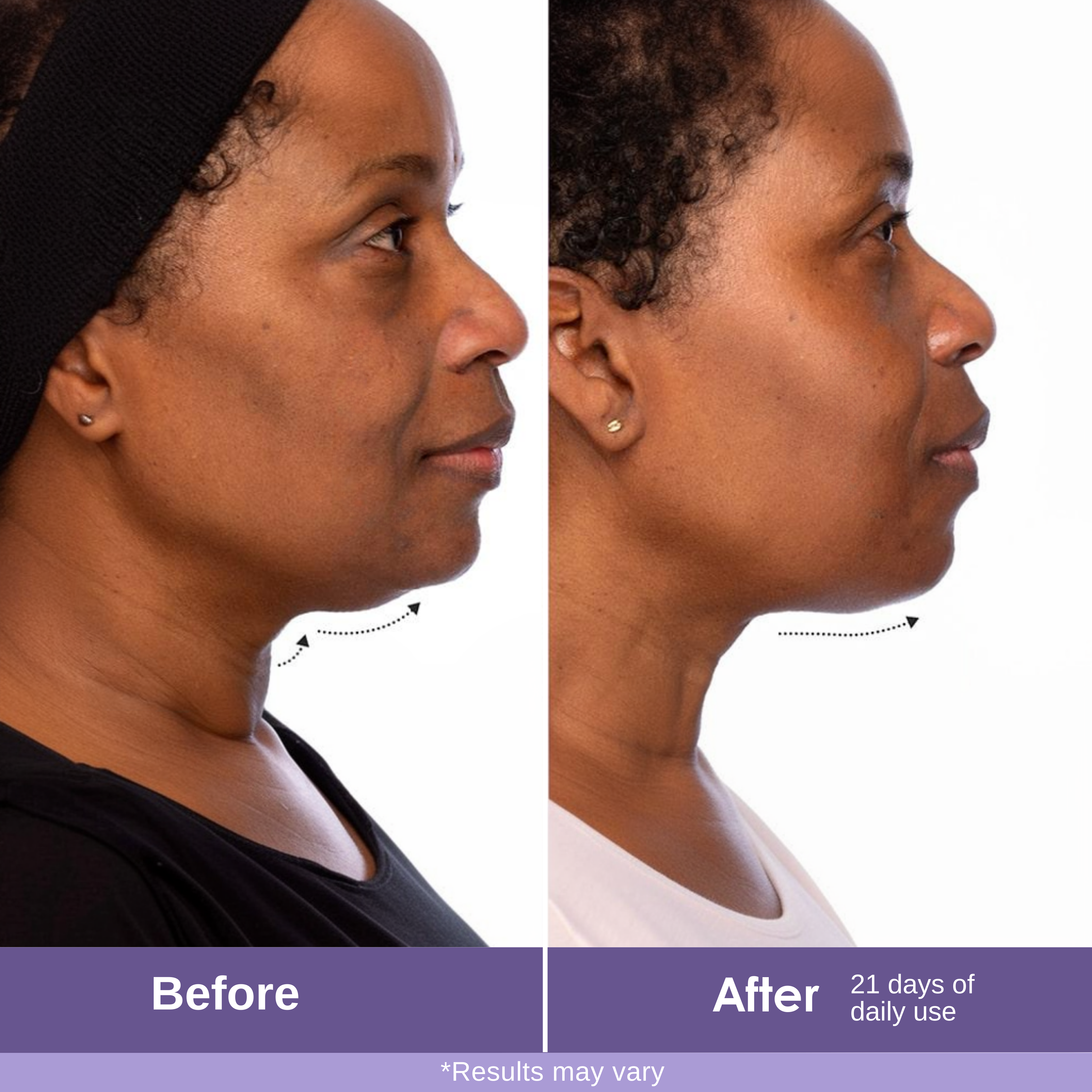 Thighten and Ligft neck cream